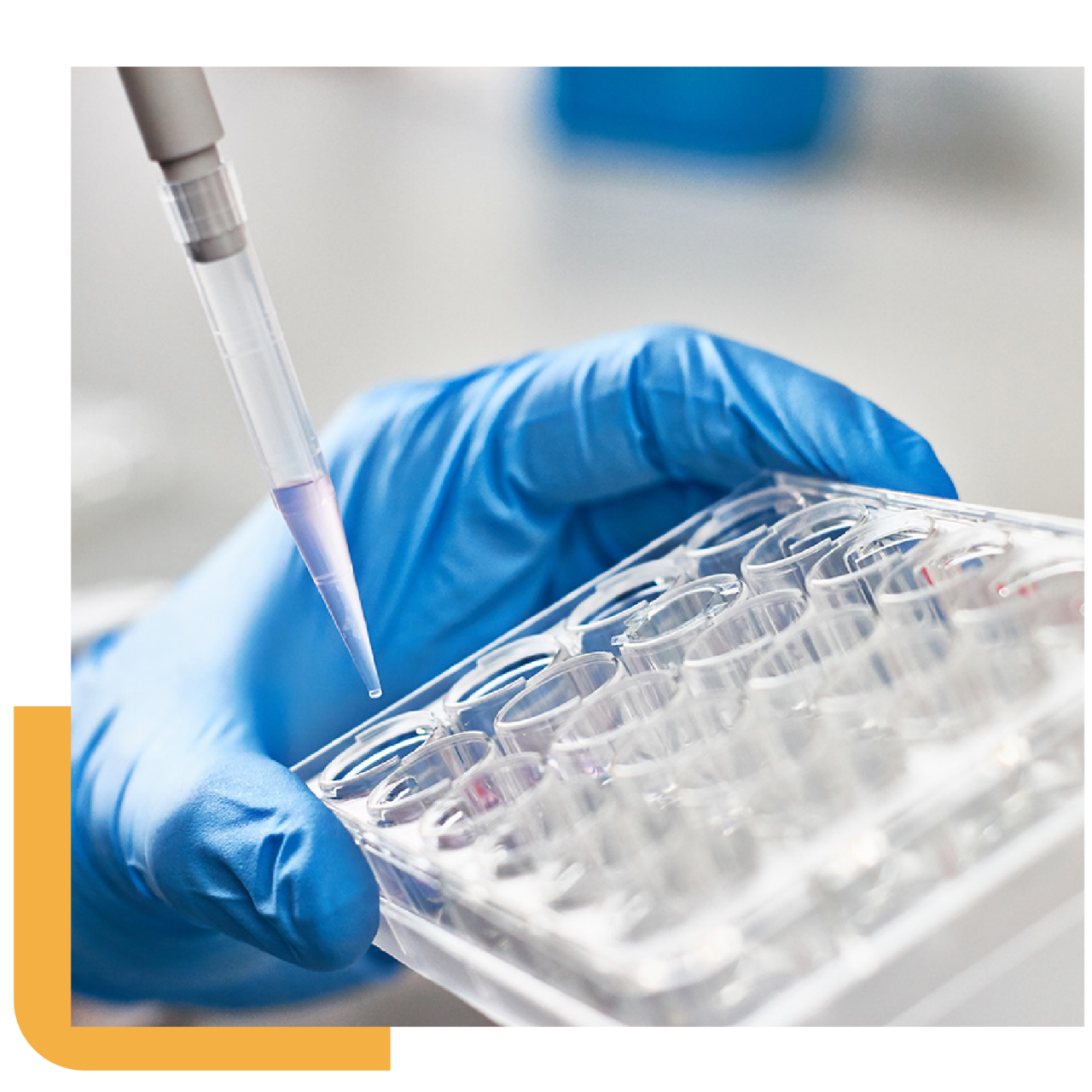 Supplement Form Options - Uckele